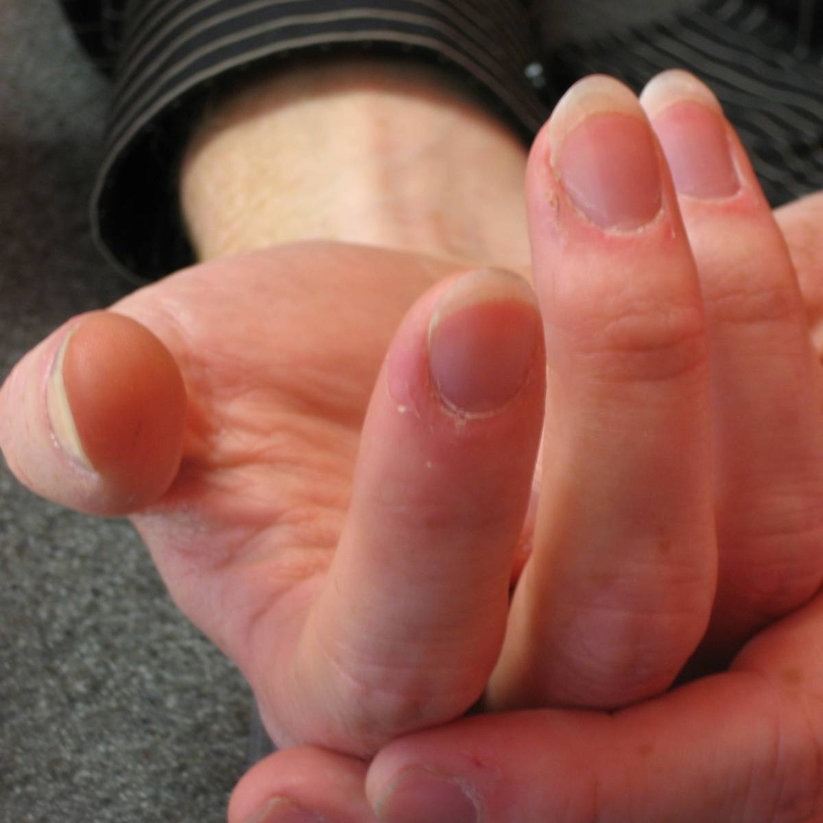 Right hand fingernails of a guitar player