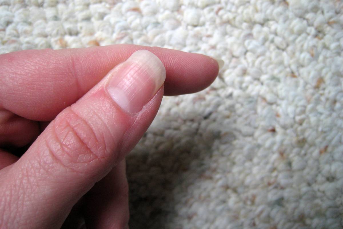 A picture of the thumb nail which is quite long, the right length for guitar playing